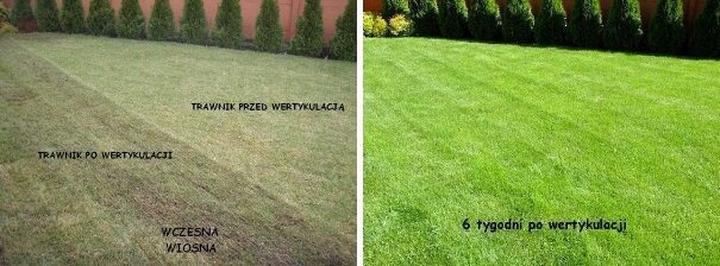 Techniki wertykulacji