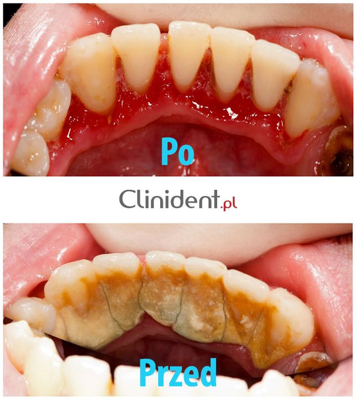 Usuwanie kamienia w łazience